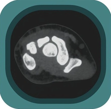 CT wrst anatomy icon